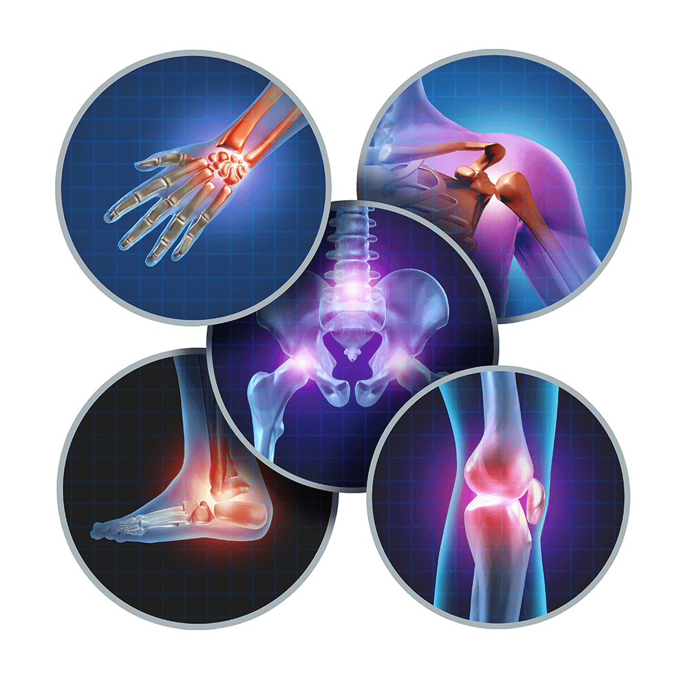 ArthroVita – Gelenk-Komplex (Pulver)